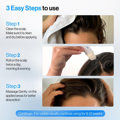 Be Bodywise Hair Growth Roll-On Serum | Black Friday & Cyber Monday BFCM Deal | 3% Rosemary, 3% Redensyl, 2% AnaGain | Precision Scalp Applicator | Paraben/Sulphate-Free | Non-Oily | DHT-Blocking Botanicals | Holiday Gift-Ready